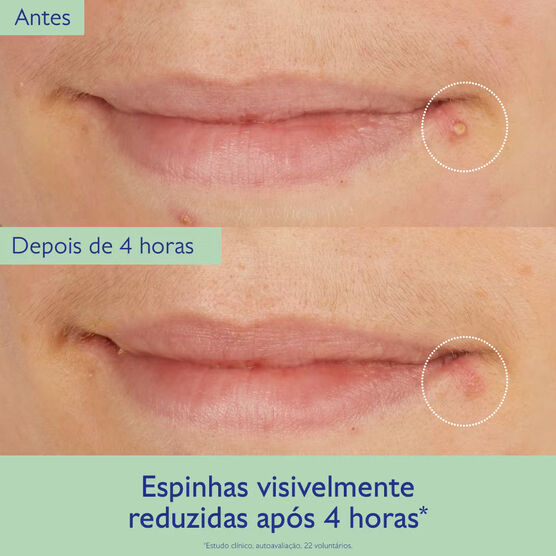 Solução Secativa Salicílica Caudalie Vinopure